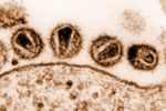 Foto: HIV-Viren, © Gelderblom.seddin@onlinehome.de