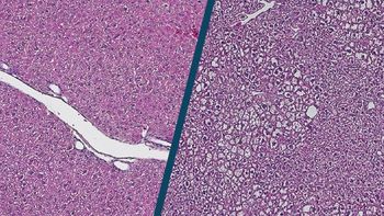 Bild: Im Alter verändert sich die Struktur der Leber. Hier gezeigt eine Histologie-Aufnahme von jungen (links) und alten (rechts) Leberzellen. © Max-Planck-Institut für Biologie des Alterns