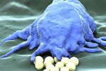 Foto: Makrophage © Juan Gärtner_Fotolia.com