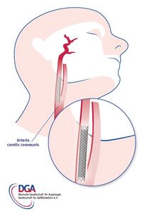 &copy; Deutsche Gesellschaft f&uuml;r Angiologie - Gesellschaft f&uuml;r Gef&auml;&szlig;medizin e.V.